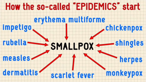 Isorokko "puhkesi" määrittelemällä kaikki rokot ja ihottumat yhdeksi sairaudeksi, kuten vesirokko, tuhkarokko ja niin edelleen. Näin lääketeollisuus synnyttää epidemiat. Kaikki on vain määritelmäkysymyksiä - muistakaa tämä!
kuvan lähde https://odysee.com/@katie.su:7/thetruthaboutsmallpox